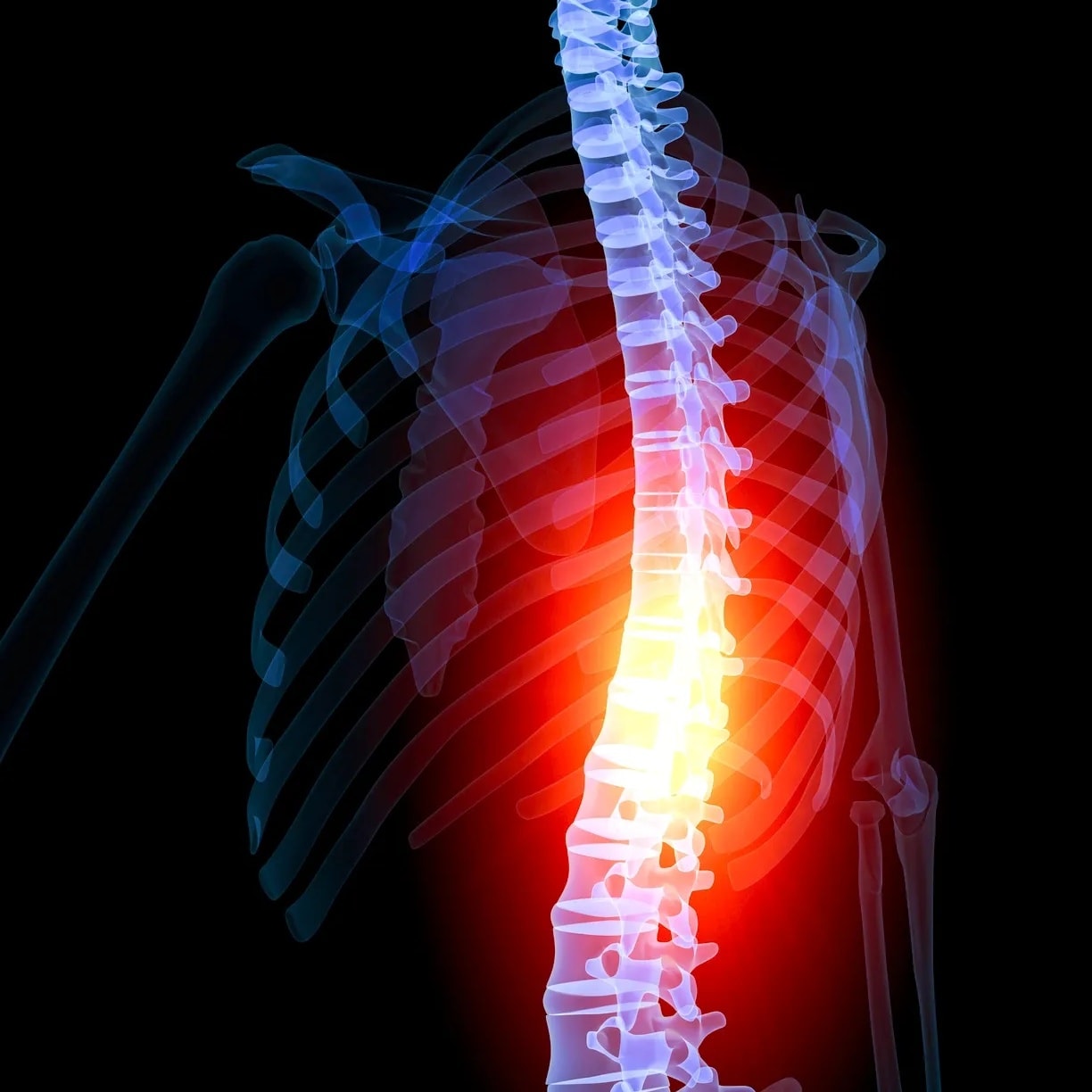 Chiropractic spinal adjustment